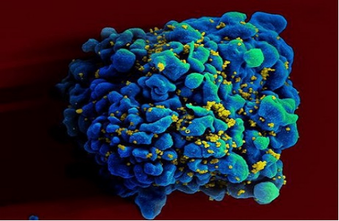 总编辑圈点|利用新冠疫苗平台技术 实验性mRNA艾滋病疫苗前景看好