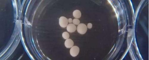 “迷你”人脑可能变得有意识并能感受疼痛